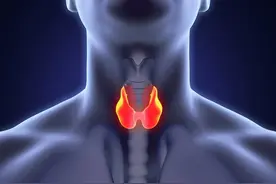 甲状腺结节分级怎么看？TI-RADS 3级、4级到底要不要紧？图片