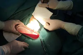 97岁超高龄患者重获新生——微创手术让年龄不再是手术禁区图片