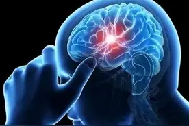为何脑梗死容易复发？医生直言这三点做不好，二次复发是迟早的事图片