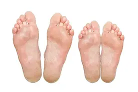 手心、脚心总出汗，可能身体出了问题，中医专家告诉你需尽快调理图片