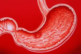 胃不好的人来说，这些水果最好不要吃，吃多了会让胃病更严重图片