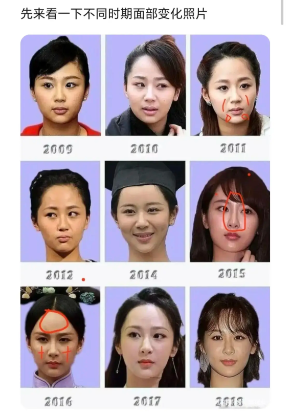 用力过猛？31岁杨紫面相变了，走上“不归路”	，张艺谋的话应验了