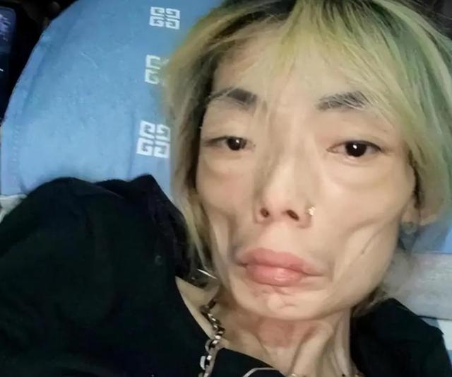 豪门玩物，8年被折磨成牙齿全掉，不足80斤，形似骷髅，惨不忍睹
