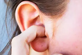 耳朵能知身体状况？医生：耳朵若出现这几种症状，可能是疾病前兆图片