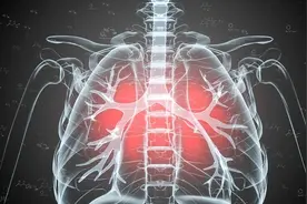 肺积水和肺癌的区别图片