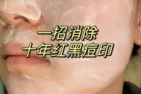 实现一键磨皮不是梦！只需两招，轻松祛除痤疮、痘印和痘坑！图片