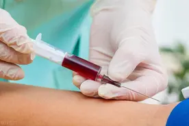 手臂淤青一大片？静脉采血后如何正确护理？图片