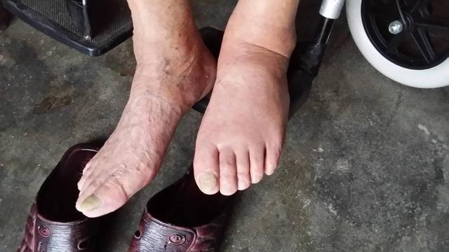 老人走路别贪多，60到70岁老人，走多少合适？医生建议来了