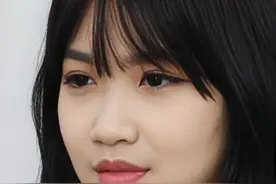 25岁广东姑娘鼻头大、宽，鼻梁塌，来北京做整形，术后即刻逆袭！图片