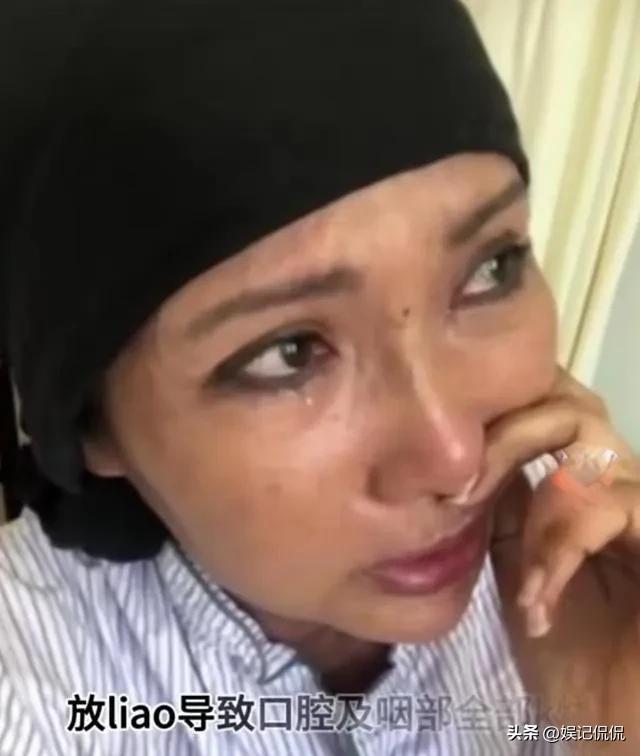 太惨!歌手张咪确诊第3种癌症,将切掉一半舌头,本人崩溃曝细节