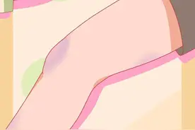 女人的大腿内侧，为什么总是黑黑的？图片