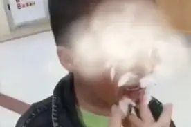 去了趟水上乐园，男孩脸上出现“小肉粒”！戏水警惕“泳池病”图片