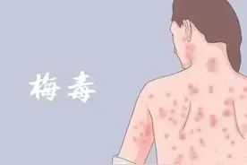 2020年，深圳一女博士确诊梅毒，她的1个坏习惯，警醒众多人图片