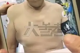 吃花生瓜子能丰胸？50岁男子狂吃花生瓜子胸部变大！网友坐不住了图片
