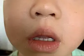 立秋后，用它给孩子泡脚，补阳气！阳气足了湿气散了，鼻炎也没了图片