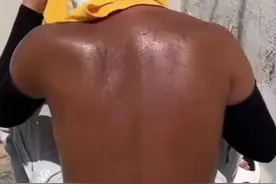 对了,大家晒背都治好了哪些毛病?图片