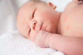 准妈妈注意了！这几种孕期行为是宝宝胎记出现的元凶图片