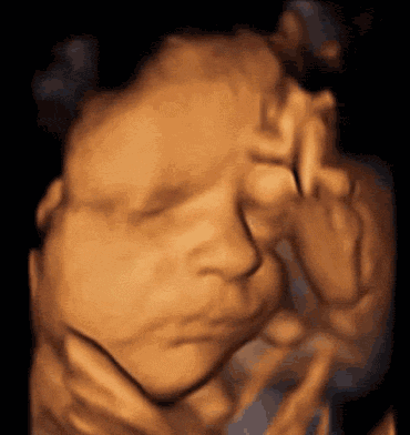 NT和四维哪个看胎儿性别更准确？产科医生告诉你真相