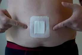揭秘脐疝：了解这种高发但鲜为人知的肚脐“鼓包”疾病图片