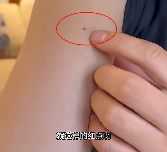 中国小伙在印度干了一杯恒河水，高烧三天全身肿胀，直言千万别喝