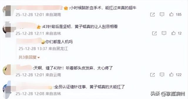 冲上热搜！黄子韬因脑淤血接受开颅手术缝了43针，本人回应