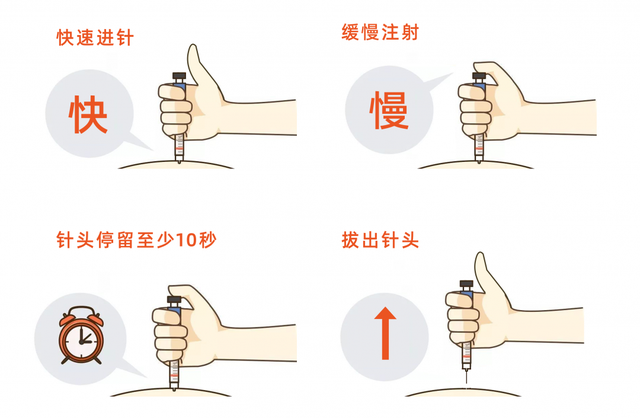 如何正确注射胰岛素