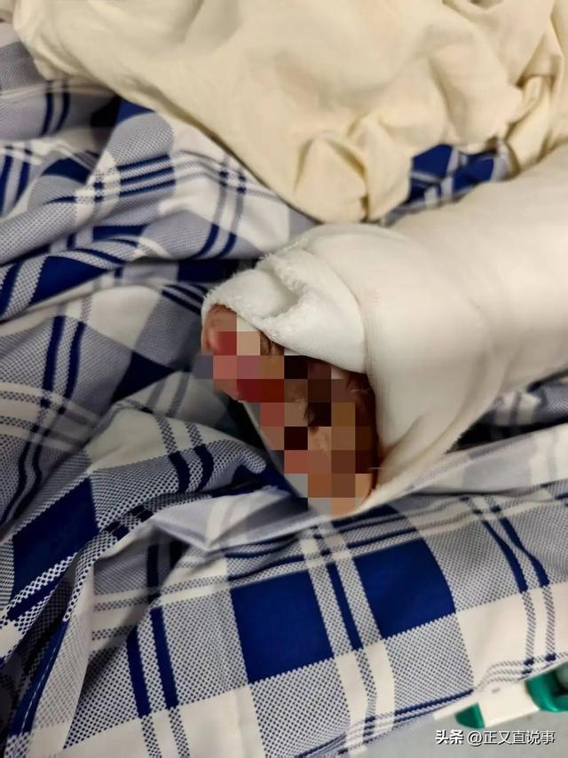 人财两空！贵州40岁男子钱开红去世，花费140万，病情本有所恢复