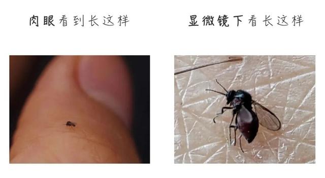 比蚊子还毒！被咬后奇痒无比，长时间难以消退！多人中招