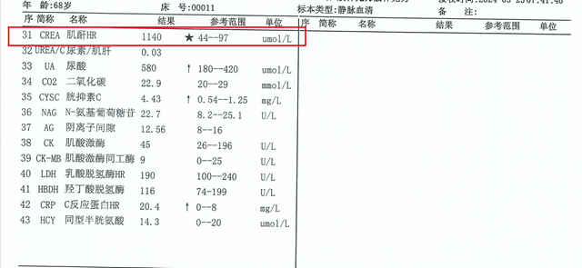 肝功球蛋白结果升高，原因竟然是因为这个疾病
