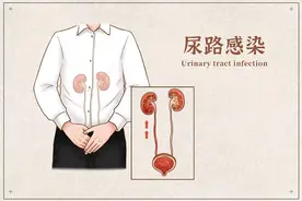 尿路感染知多少？为何我成了“易感人群”？如何治疗与预防?图片