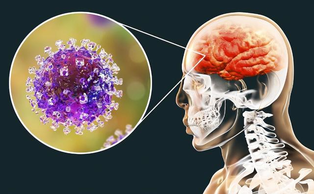 “尼帕病毒”来势汹汹，呼吁：每家备好5样东西，关键时刻能救命