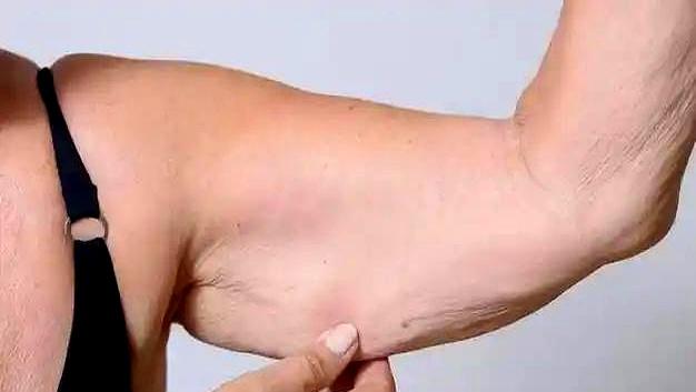 70岁后，还适合走路运动吗？医生说出答案，可能和你想的不同