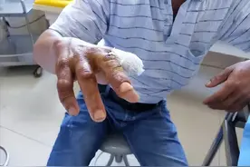 五步蛇究竟有多恐怖？被咬后只能走五步吗？砍断手指能不能保命？图片