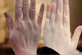 手是女人的第二张脸？揭秘逆龄美手的终极密码！图片