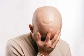为什么男人尽量不要剃光头？是什么原因，看完你就明白了图片