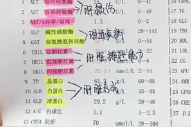 希望大家的肝功能化验单，这5项别升高！图片
