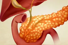 男子频繁腹泻，多次肠镜无异常，最终确诊为“癌中之王”图片