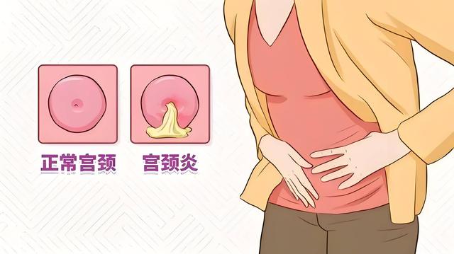 为何月经前后，会出现“褐色分泌物”？若你也有，建议对照看看