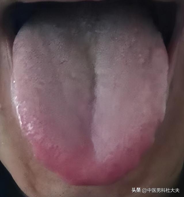 海绵体不充血，行事困难，补肝益肾，振奋坚韧，这一方足矣