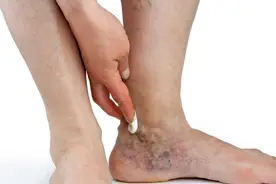 肝不好，脚知道！脚底出现4种异常，或是肝病预警信号图片