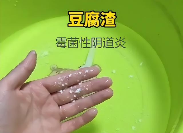 发生霉菌性阴道炎，注意这4点症状，医生告知：治疗做到这6点