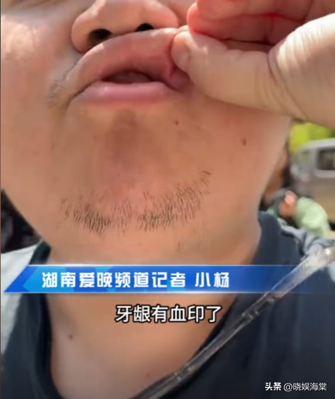 湖南记者被打后续：谢某身份被扒，难怪这么嚣张，恐面临巨额赔偿