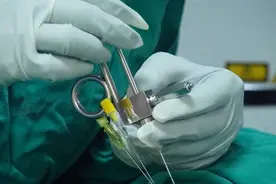 4次手术，28次化疗，肉瘤还在猛长，医生：肉瘤不要一条路走到黑图片