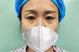 切眉后1-7天恢复图片,切眉后多久可以恢复自然？切眉后肿的严重吗图片
