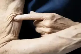止痛神方，两味中药泡水喝，可治腰腿疼、胳膊疼、颈椎疼、肩膀痛图片