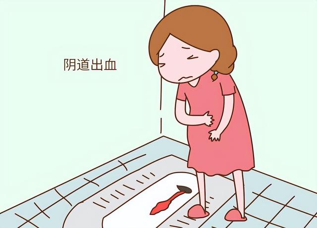 月经不调的原因有哪些？这几种情况务必就医，别忽视！