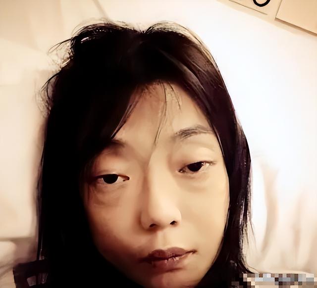 一代女神沦为豪门玩物？结婚8年牙齿全掉，器官切除，面似骷髅