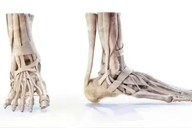 脚后跟疼怎么回事？图片