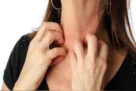 蚊子最大克星竟然不是蚊香？其实驱蚊很简单，开窗睡觉都不怕图片