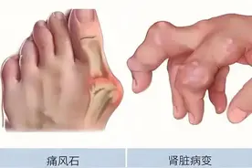 饮料可以不喝，4种内调的水，不要错过！既降尿酸还排尿酸！图片